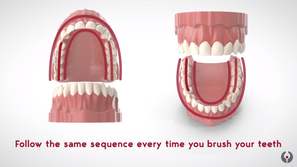 Technique de brossage sulculaire